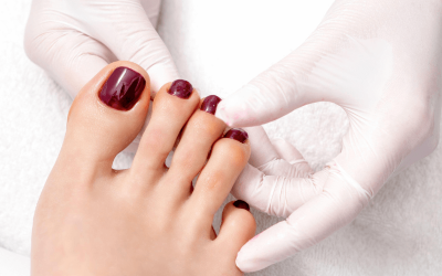 5 Signs of Toenail Problems and What They Mean
