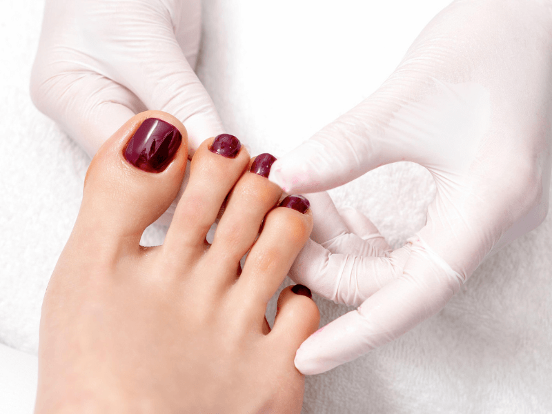 5 Signs of Toenail Problems and What They Mean