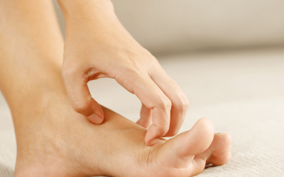 The 5 Major Causes of Itchy Feet