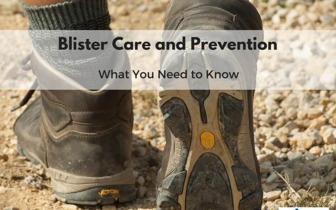 Blister Care and Prevention, What You Need to Know