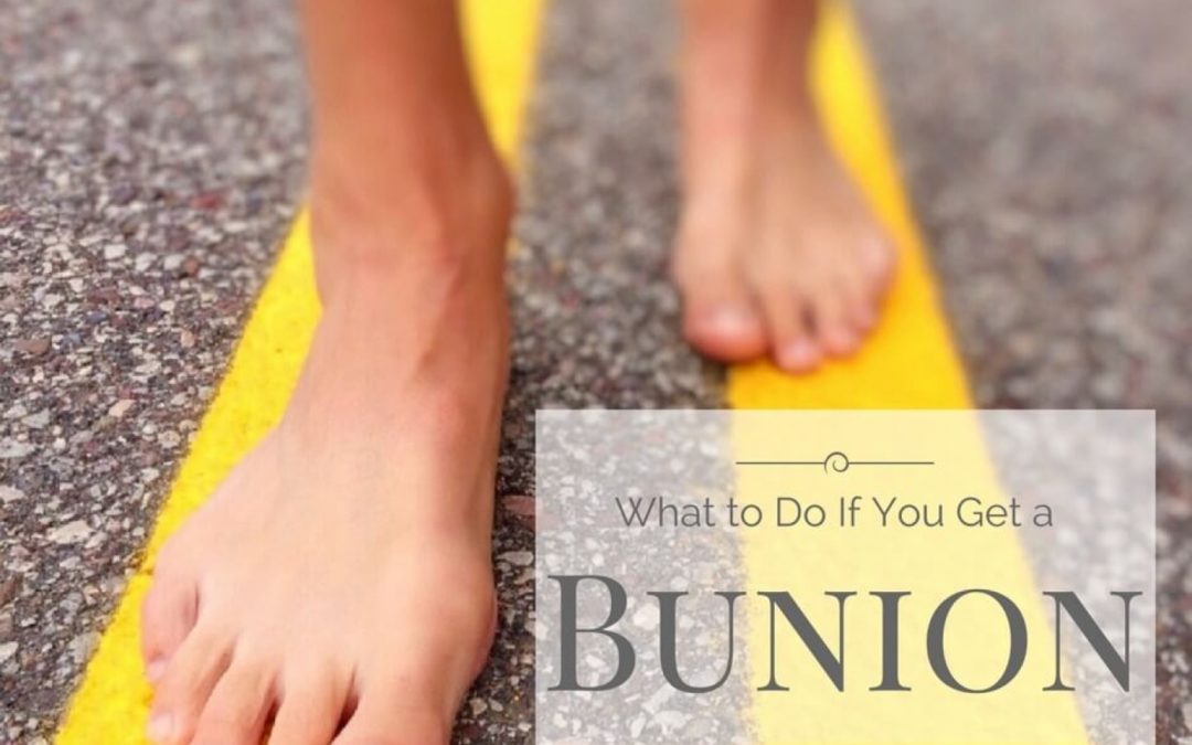 What to Do If You Get a Bunion