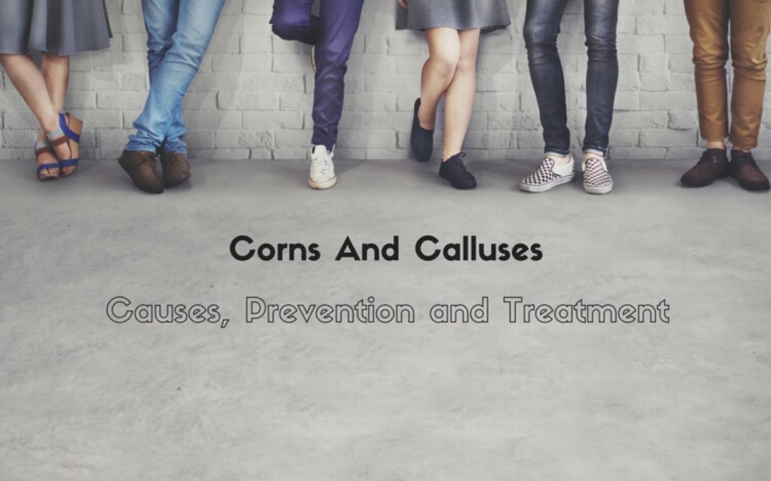 Corns And Calluses