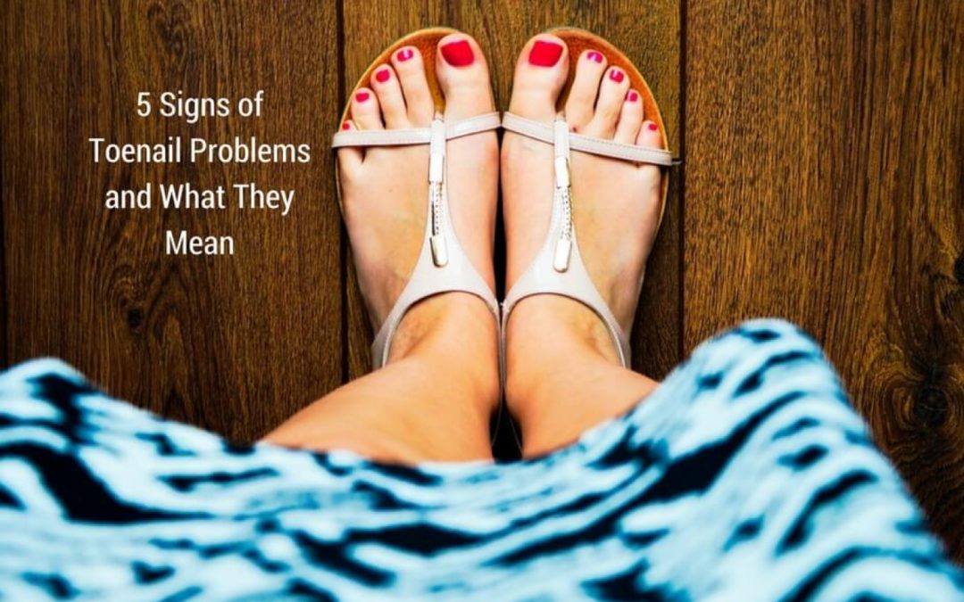 5 Signs of Toenail Problems and What They Mean