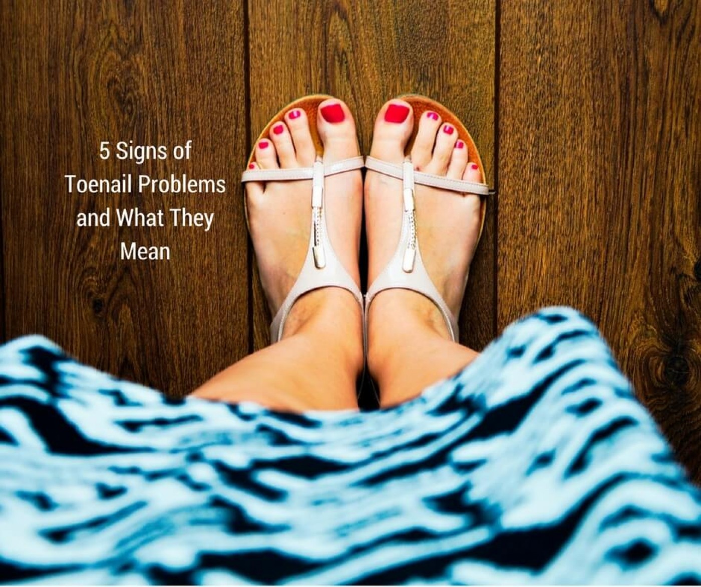 5 Signs of Toenail Problems and What They Mean