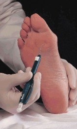 Insoles podiatry - Feet By Pody