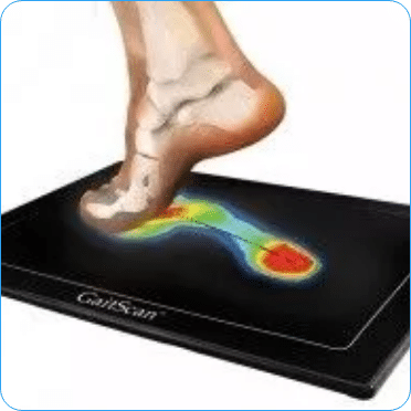 FBP_SERVICES_ServicesList_Image1_1530 Gait Scan analysis