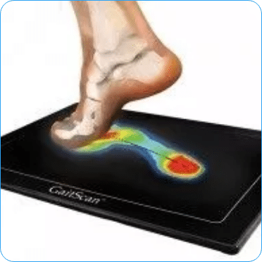 Gait Scan analysis