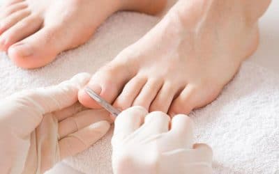 How to Cut Your Toenails and When to Ask Your Podiatrist for Help