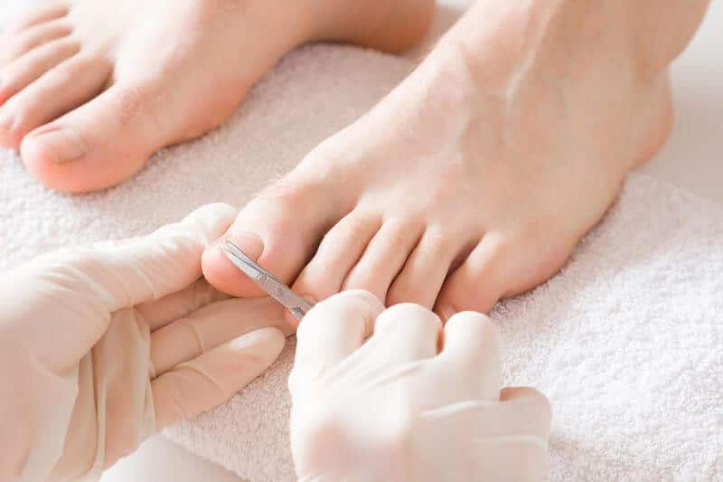 How to Cut Thick Toenails and Make Toenails Thin