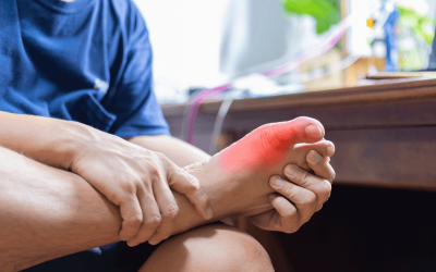 Gout in Your Big Toe: Practical Steps to Relieve the Pain