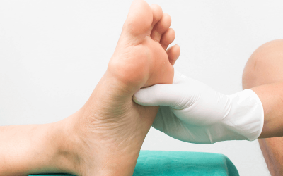Diabetic Foot Care: Why Seeing a Chiropodist Could Save Your Feet