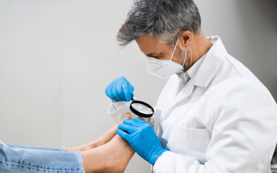 From First Twinge to Surgery: A Complete Guide to Ingrown Toenails