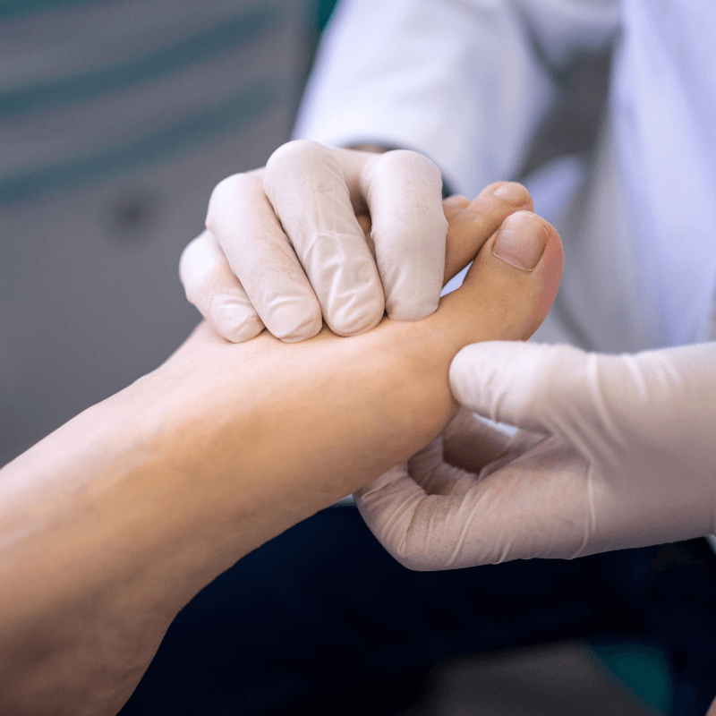 Podiatry Assessment in London